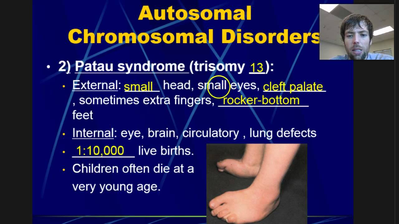 Chromosomal Disorders