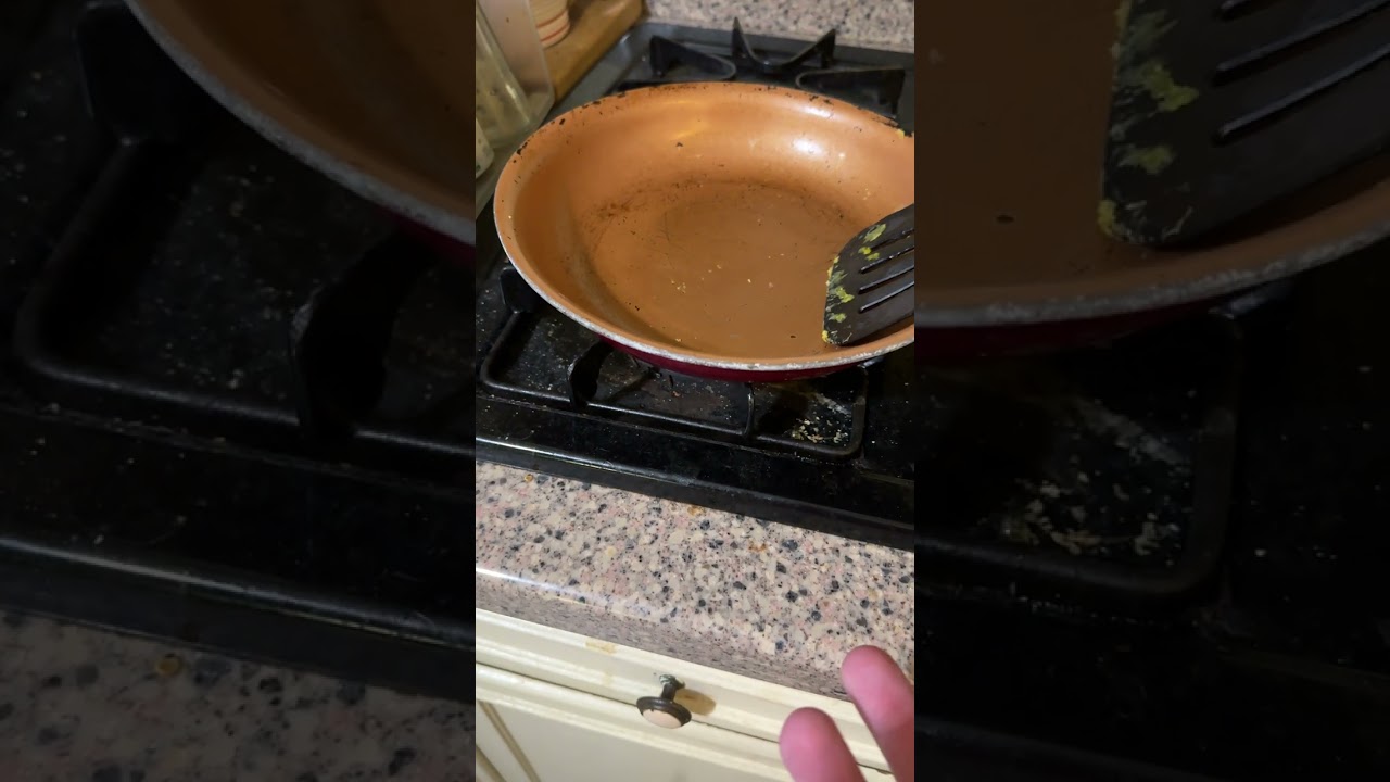 Dose Your Hands Hurt When You Burn Them