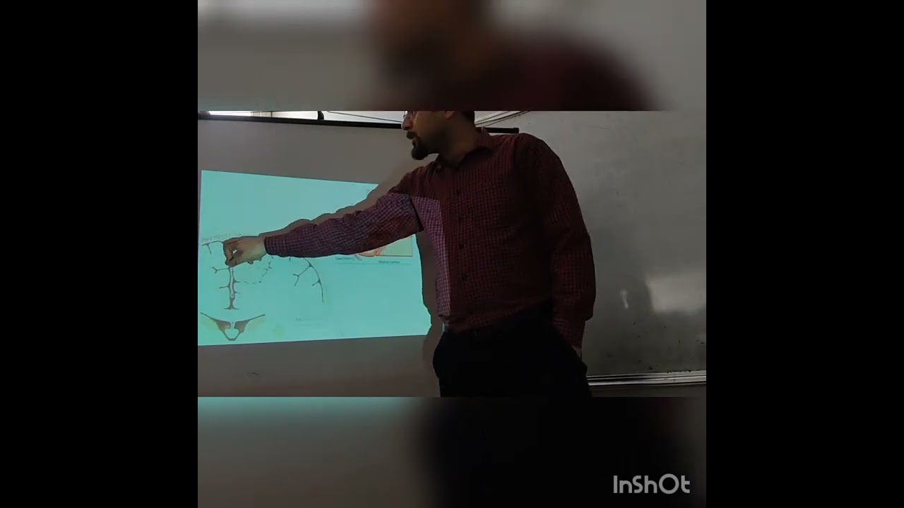 جراحة عصبية د.أنس بيطار  (محاضرة أورام الدماغ )