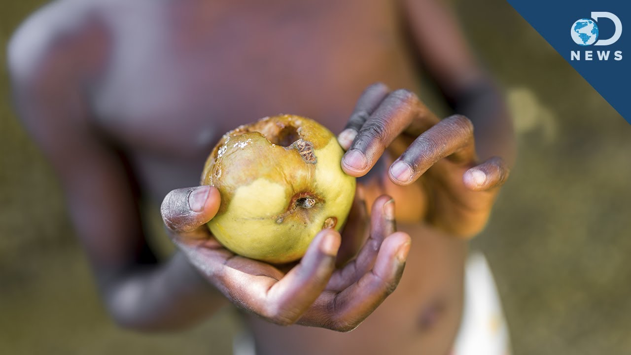 Why Malnourished Children Might Never Recover!