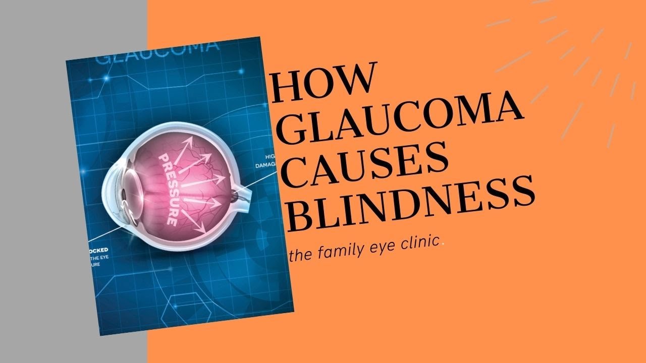 Glaucoma Blindness