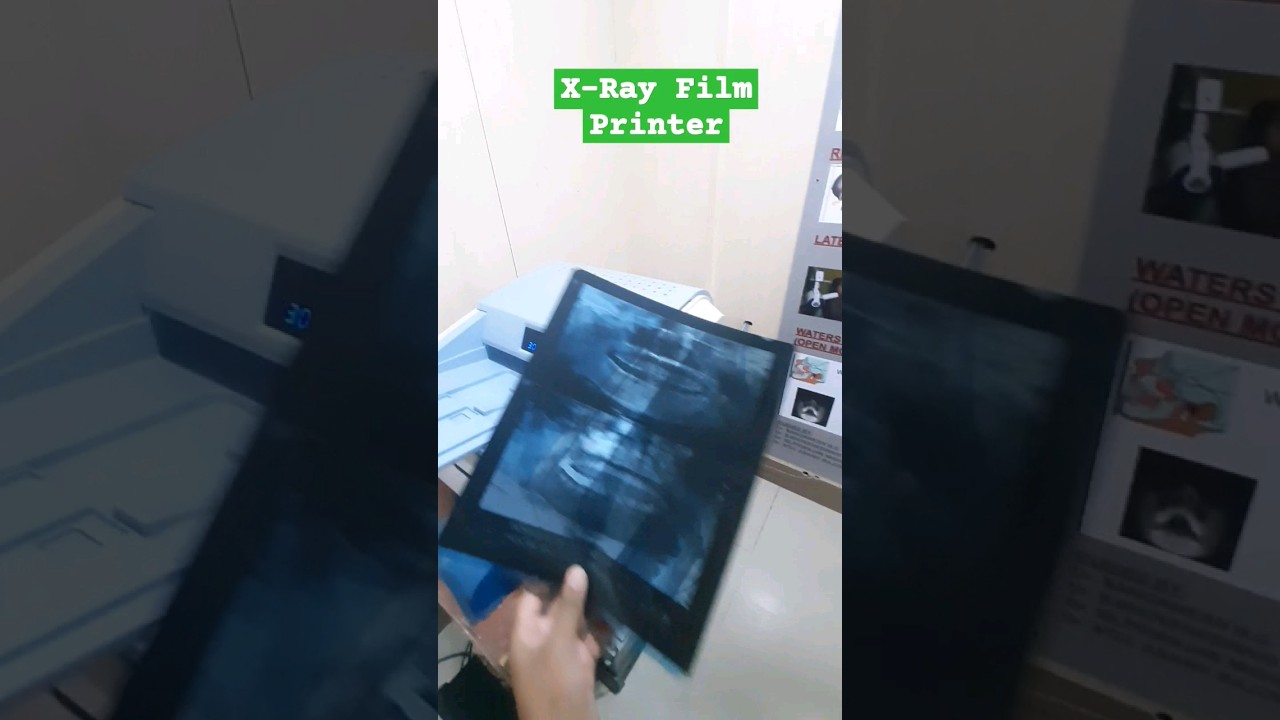 X-ray film Printer produce high-resolution radiographic images on X-ray film