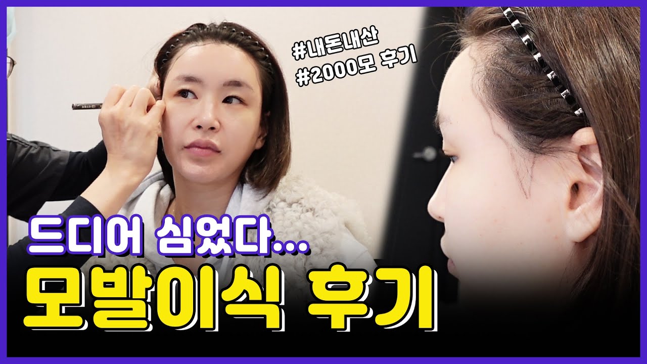 드디어...심었다... 모발이식  l 시술V-logㅣBaeYoonJung TV #모발이식 #내돈내산 #협찬아님