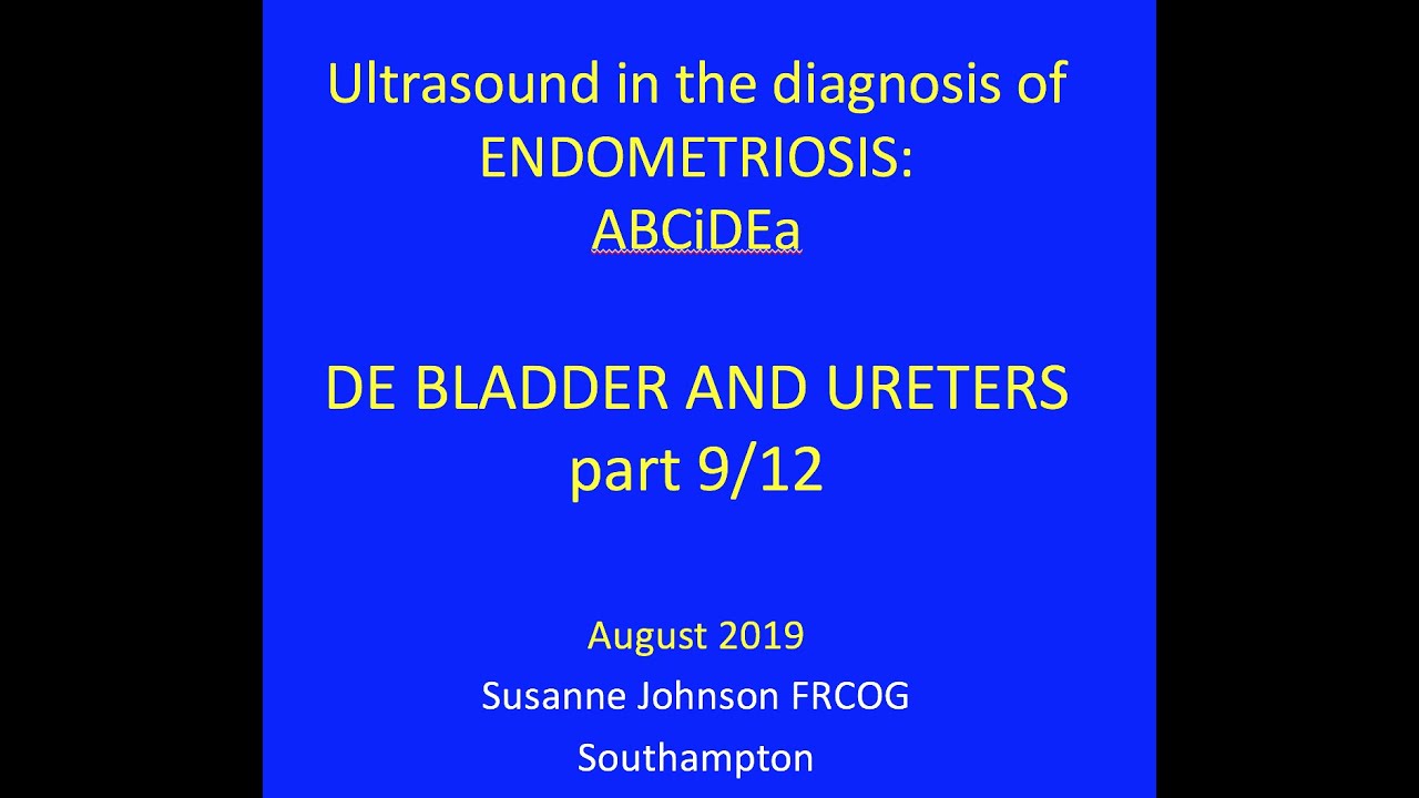 9/12 ABCDЭндометриоз - ГИЭ в мочевом пузыре и мочеточниках