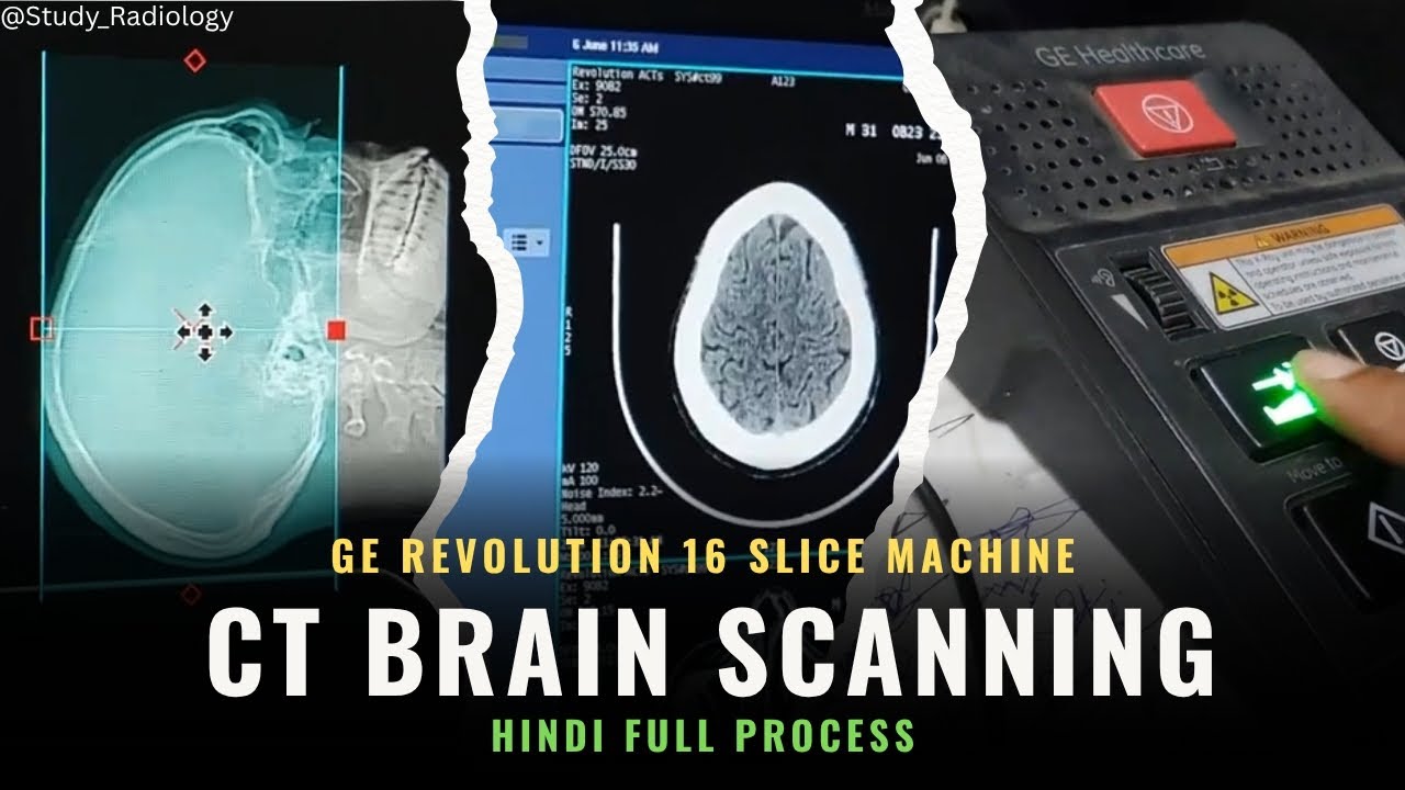 CT Brain Scanning On GE Revolution 16 Slice Machine | Full Process in Hindi | @Study_Radiology