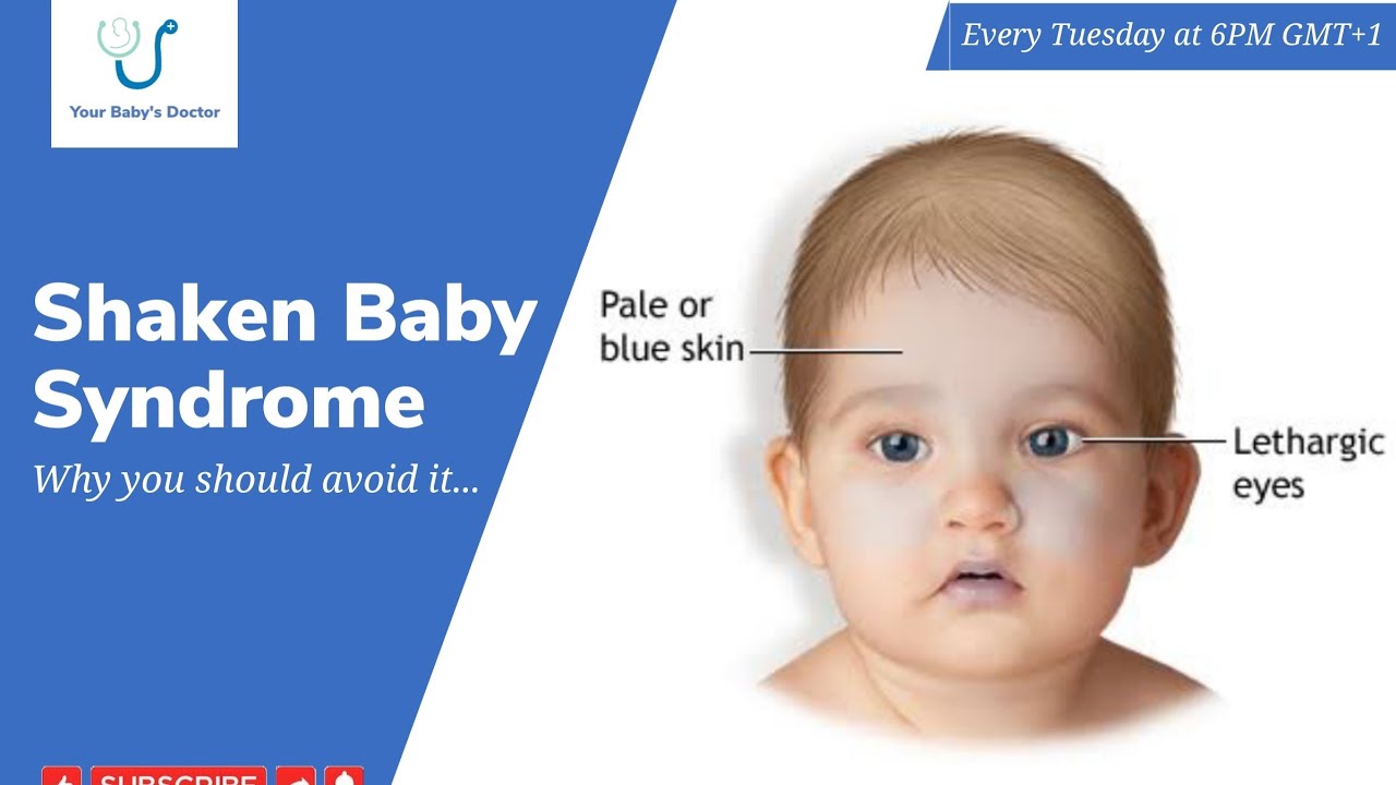 Your Baby's Doctor | Shaken Baby Syndrome | What to know about SBS