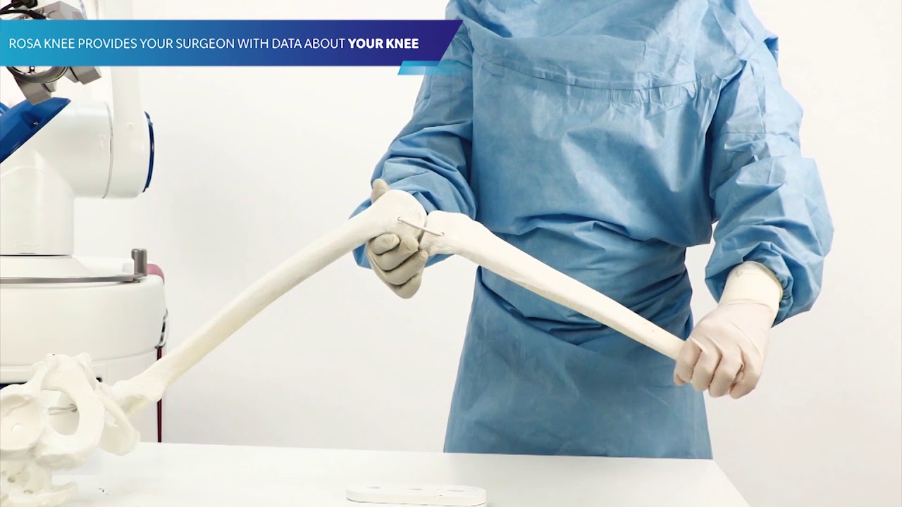 Zimmer Biomet ROSA Knee Patient Video