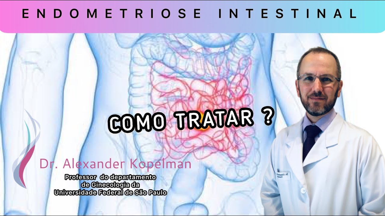 TUDO SOBRE A ENDOMETRIOSE INTESTINAL