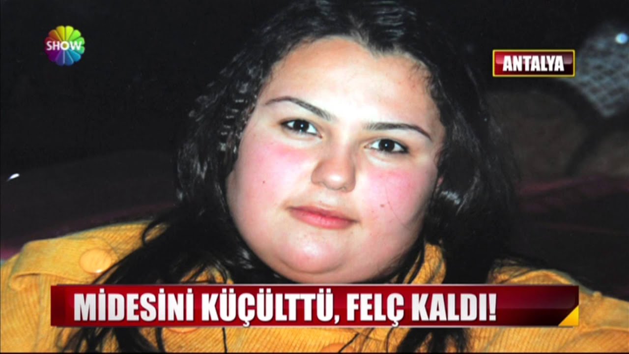 Midesini küçülttü, felç kaldı!
