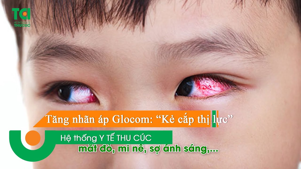 👁️‍🗨️ Tăng nhãn áp Glocom: “Kẻ cắp thị lực” nguy hiểm của đôi mắt