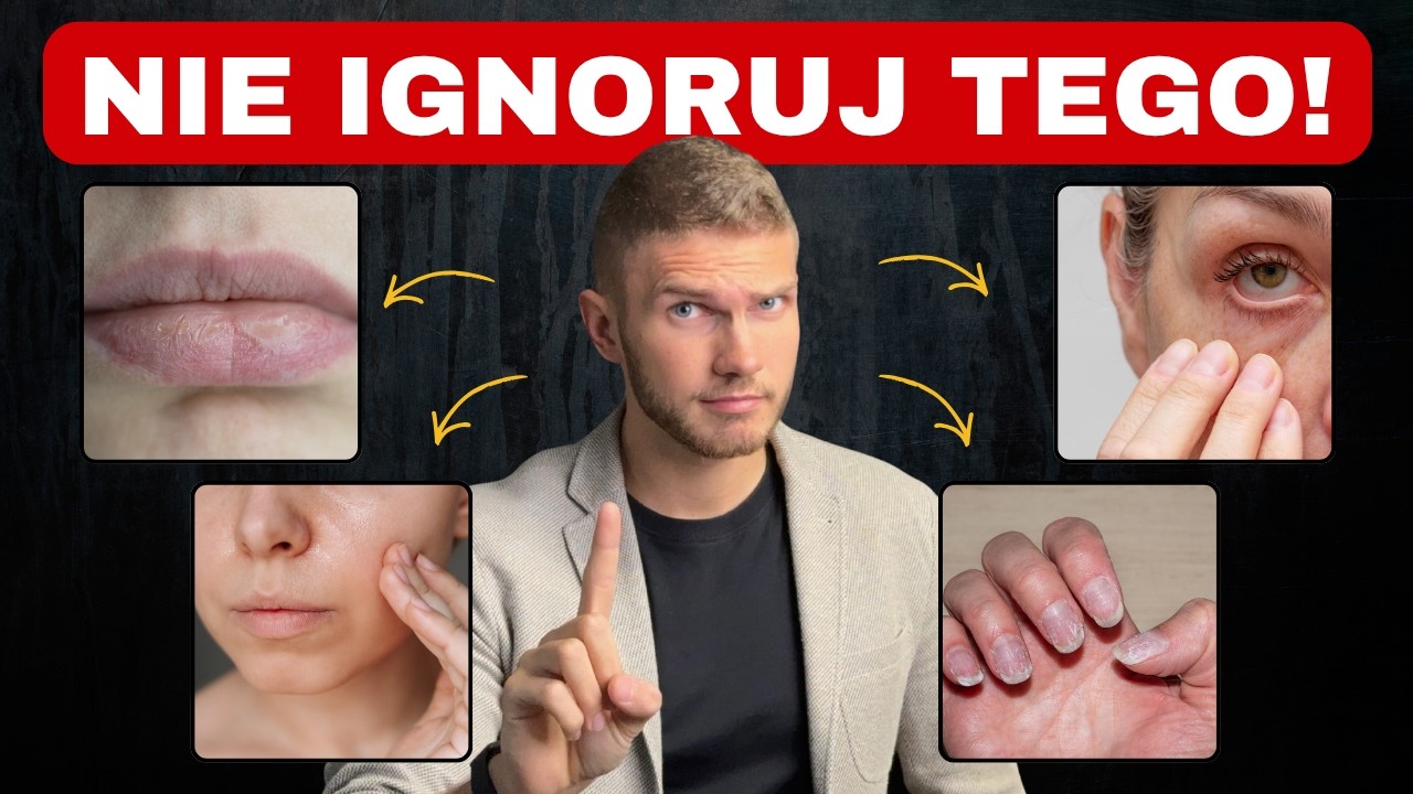 23 oznaki niedobor&oacute;w w organizmie! Nie możesz tego lekceważyć!