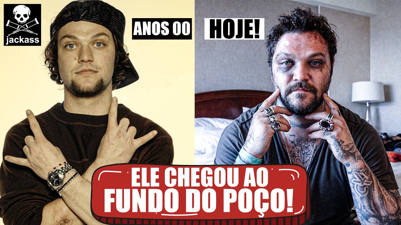 QUEBRADOS E SEQUELADOS: O TRISTE FIM DOS MEMBROS DO JACKASS!