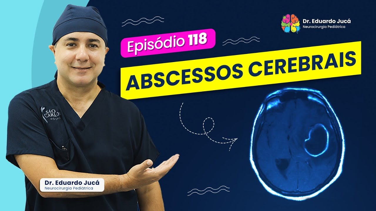 ABSCESSOS CEREBRAIS | EP.: 118