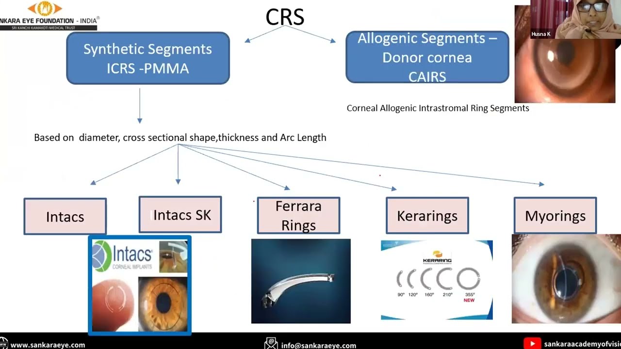 Corneal ring segments &ndash; indications and complications