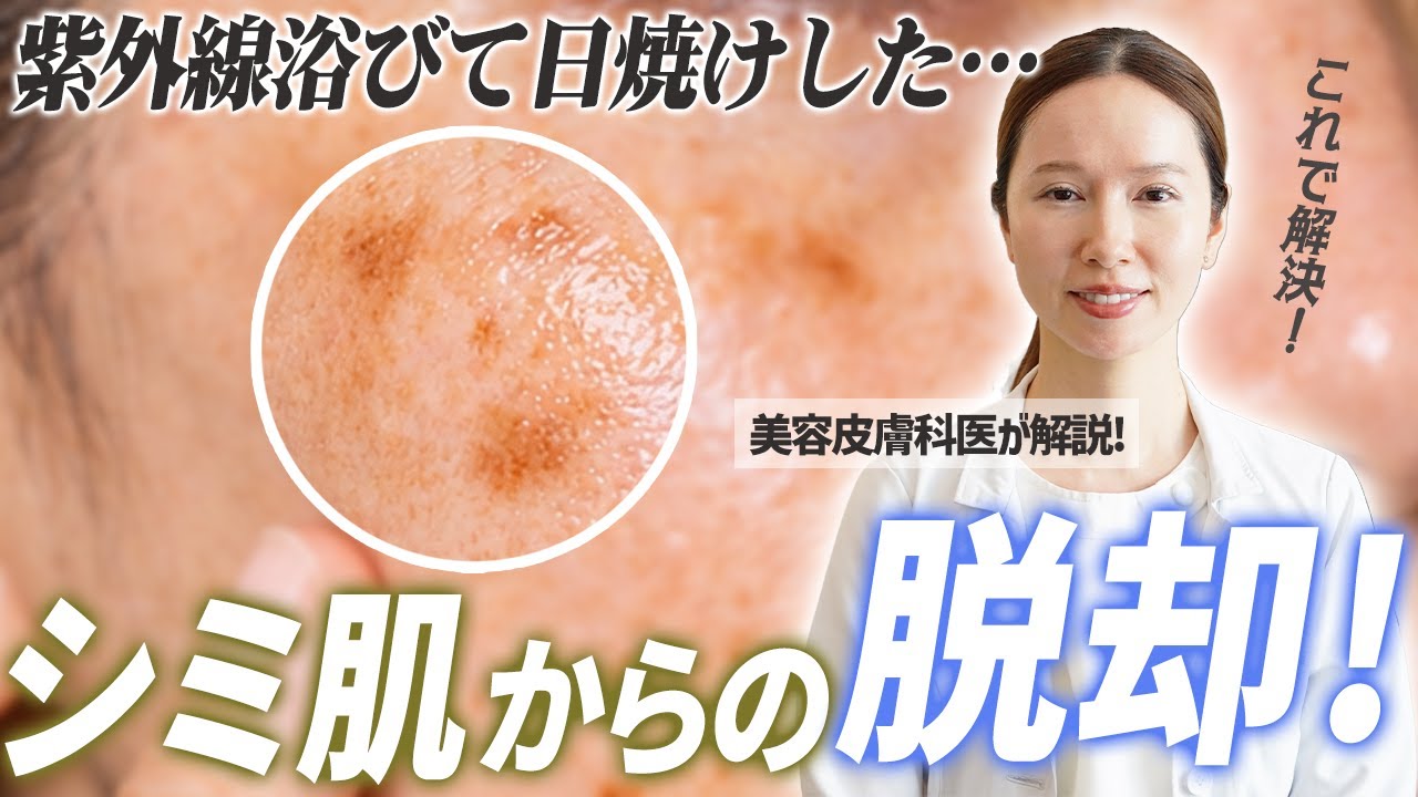 【シミの原因】ハイドロキノンの成分を理解してシミのない綺麗なおばさんになるための近道の方法を紹介します！