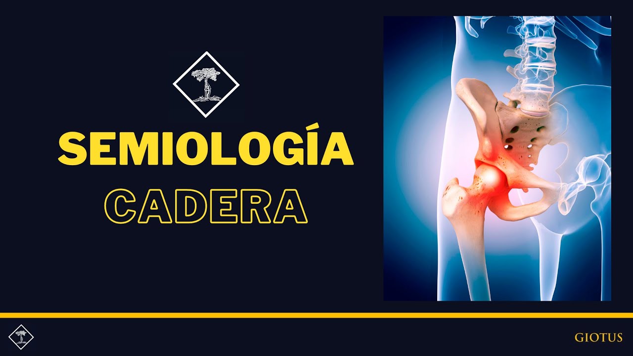 Semiología de cadera
