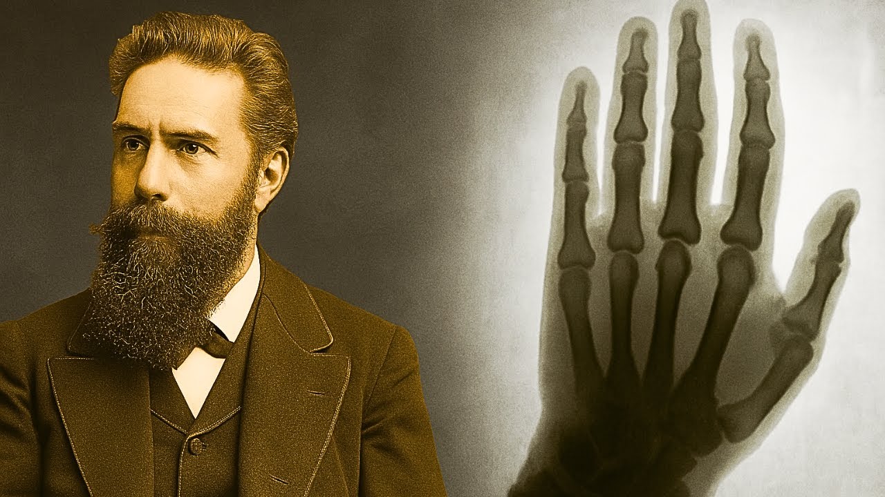 Wilhelm R&ouml;ntgen Der Mann, der die R&ouml;ntgenstrahlen erfand &ndash; er sah das menschliche Skelett 1895