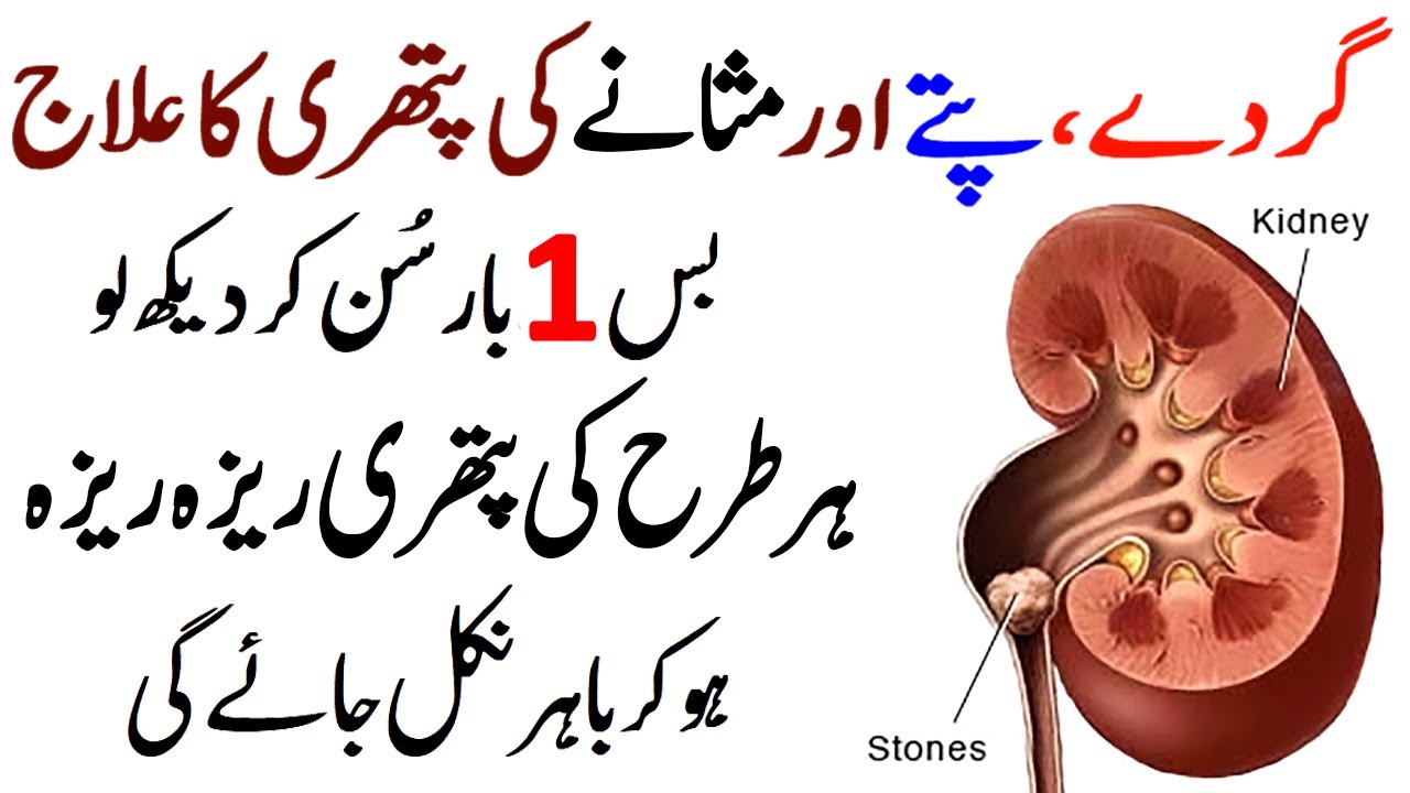 Pitte Ki Pathri Ka Wazifa | Pathri Ka Ilaj | Wazifa for Kidney Stone | Gurde Ki Pathri Ka Wazifa