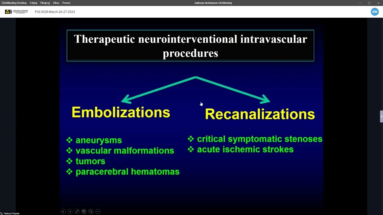 POL9028 Tadeusz Popiela Radiologia zabiegowa w neurologii