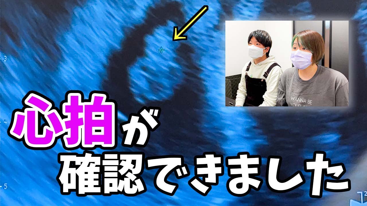 【妊娠7週】赤ちゃんの心拍が確認できました