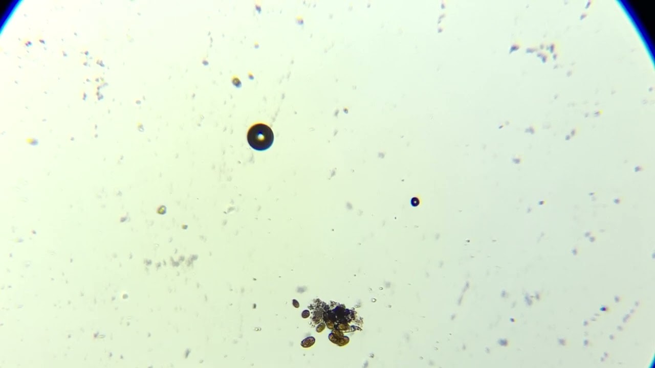 Dinoflagellate ID - Possible Large or Small Cell Amphidinium Pt.3