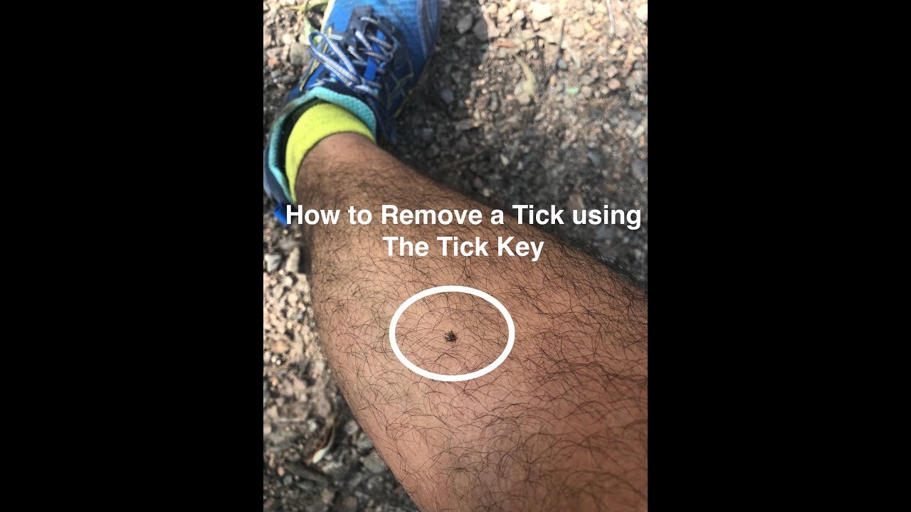 How to Remove a Tick using the Tick Key