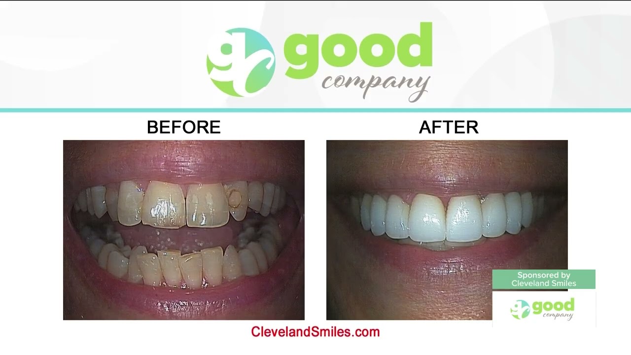 Remaking Smiles for Over 40 Years | Dr. Steve Marsh