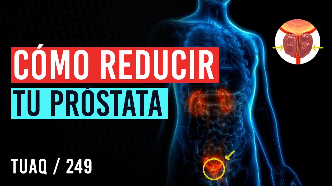 C&oacute;mo reducir tu #prostata