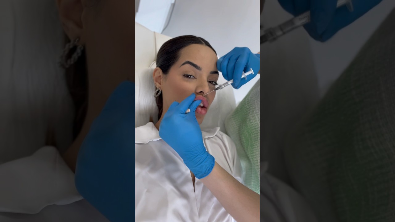 o dia que eu removi TODO o meu preenchimento labial 😅