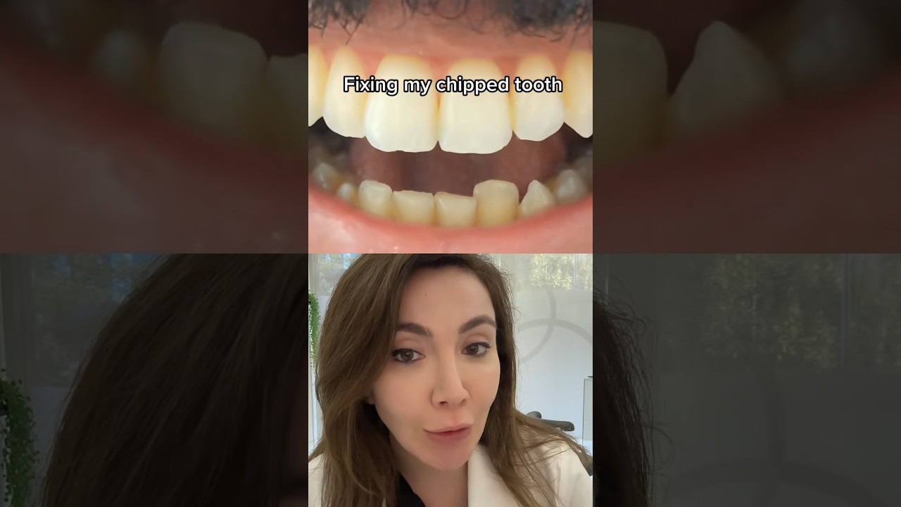 Fixing Chipped Tooth!!