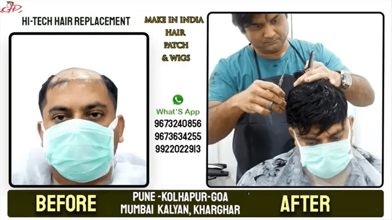 Non-Surgical Hair Replacement And Wigs PUNE KOLHAPUR GOA 9673634255/9922022913/9673240856