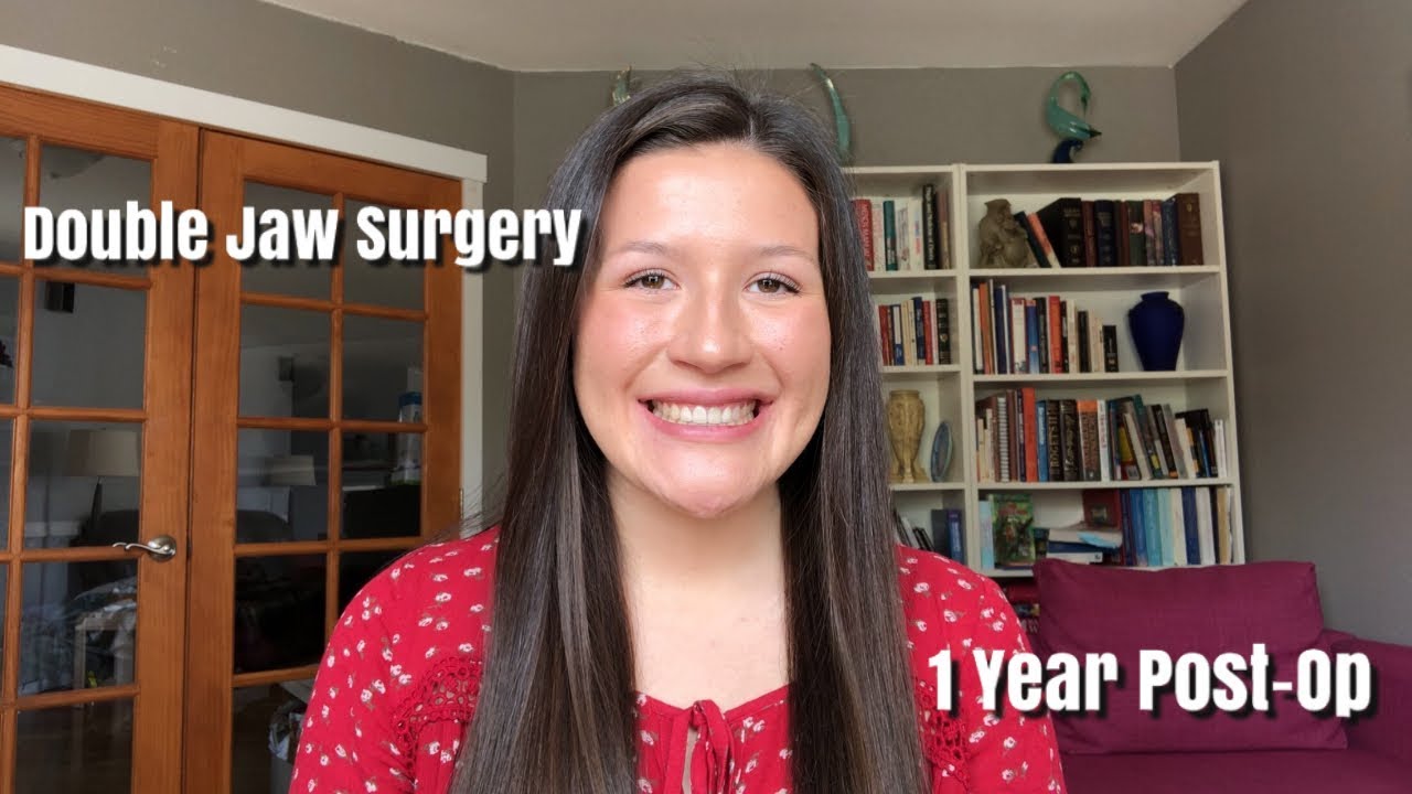 DOUBLE JAW SURGERY: 1 YEAR POST-OP (Before and After Pictures)