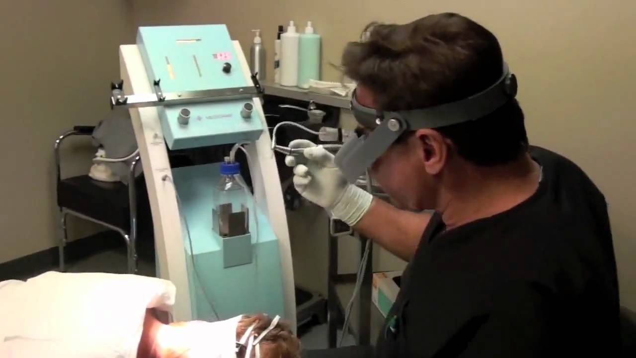 NeoGraft Hair Transplant Surgery with Dr. Robert Leonard in New England