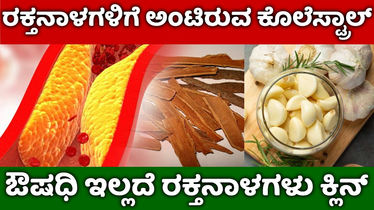 ಕೊಲೆಸ್ಟ್ರಾಲ್ ( Cholesterol ) ಆಹಾರ ಕ್ರಮ | Cholesterol Control Foods | Cholesterol Diet Chart Kannada