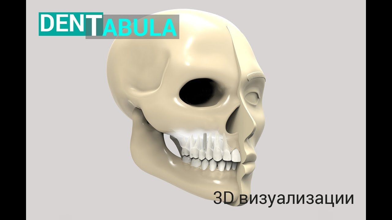 3D визуализации на сайте Dentabula