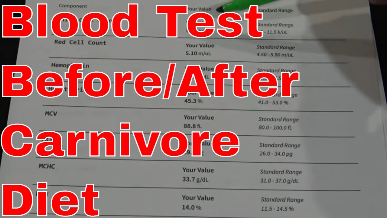 BLOOD TEST Results After 30 Days On The Carnivore Diet