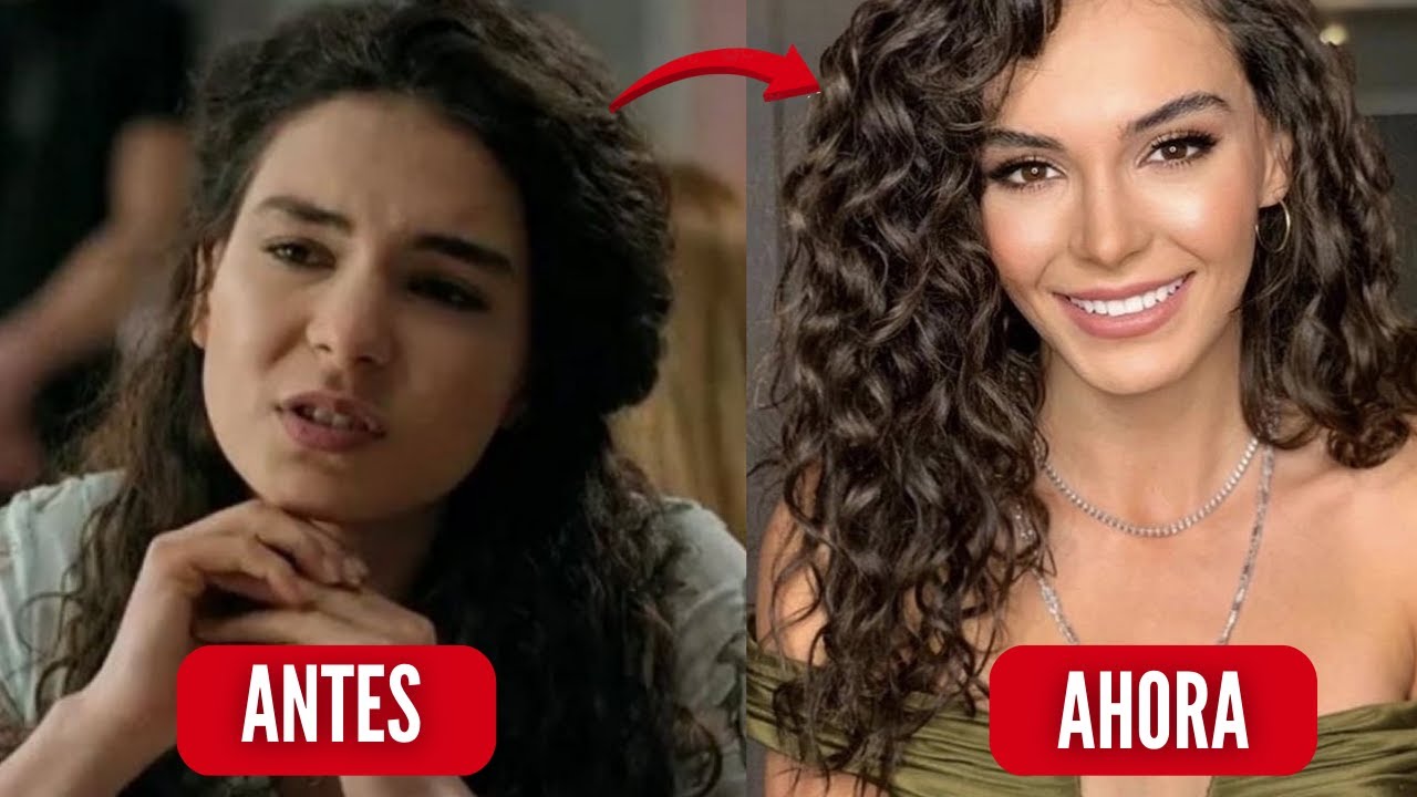 Cirugías de Ebru Sahin