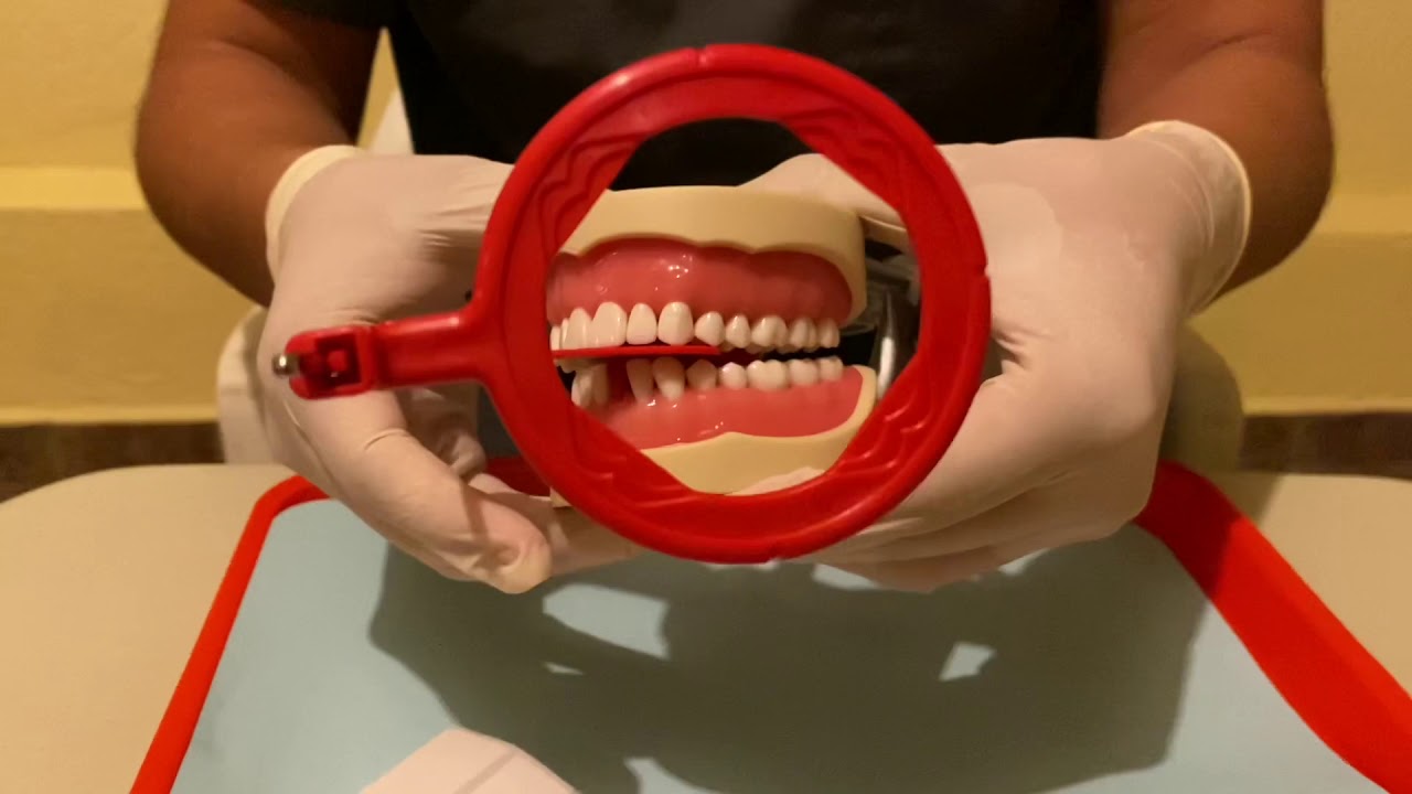 Aleta de Mordida l Radiología Bucal🦷
