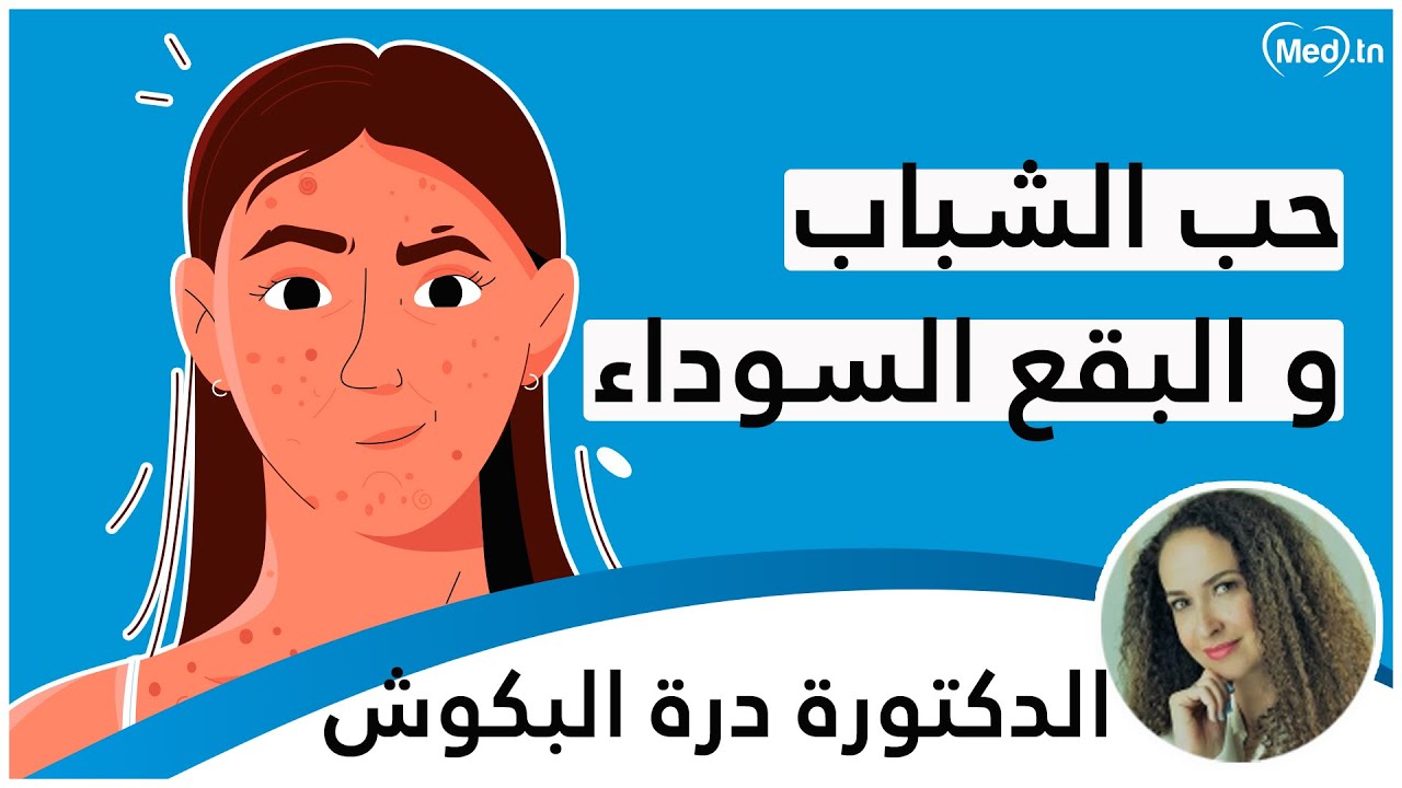 حب الشّباب و البقع السّوداء | الدكتورة درة البكوش الغنوشي