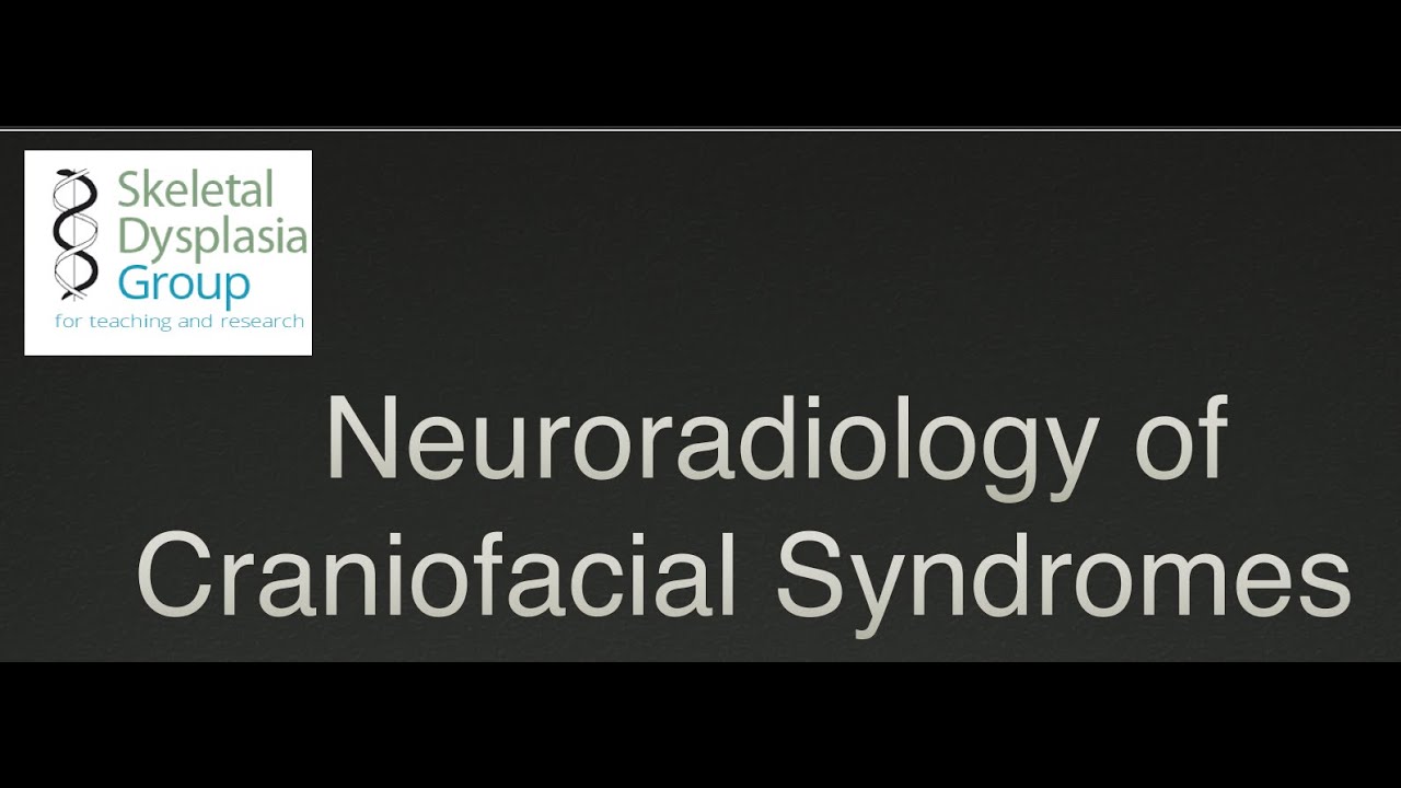 Neuroradiology of Craniofacial Syndromes: craniosynostosis and beyond