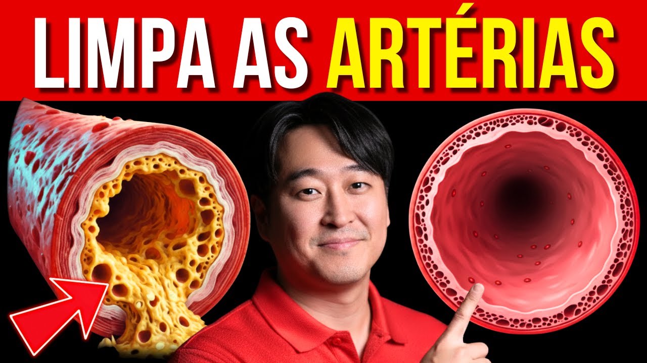 A Forma MAIS RÁPIDA de LIMPAR Artérias | Cientificamente Comprovado.