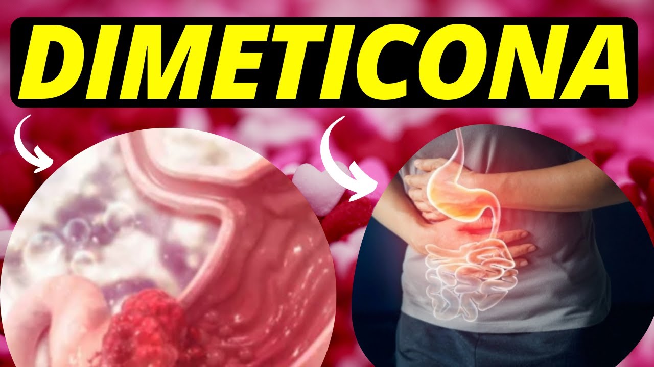 DIMETICONA: Nome comercial, mecanismo de a&ccedil;&atilde;o, contraindica&ccedil;&atilde;o, indica&ccedil;&atilde;o e cuidados de #enfermagem