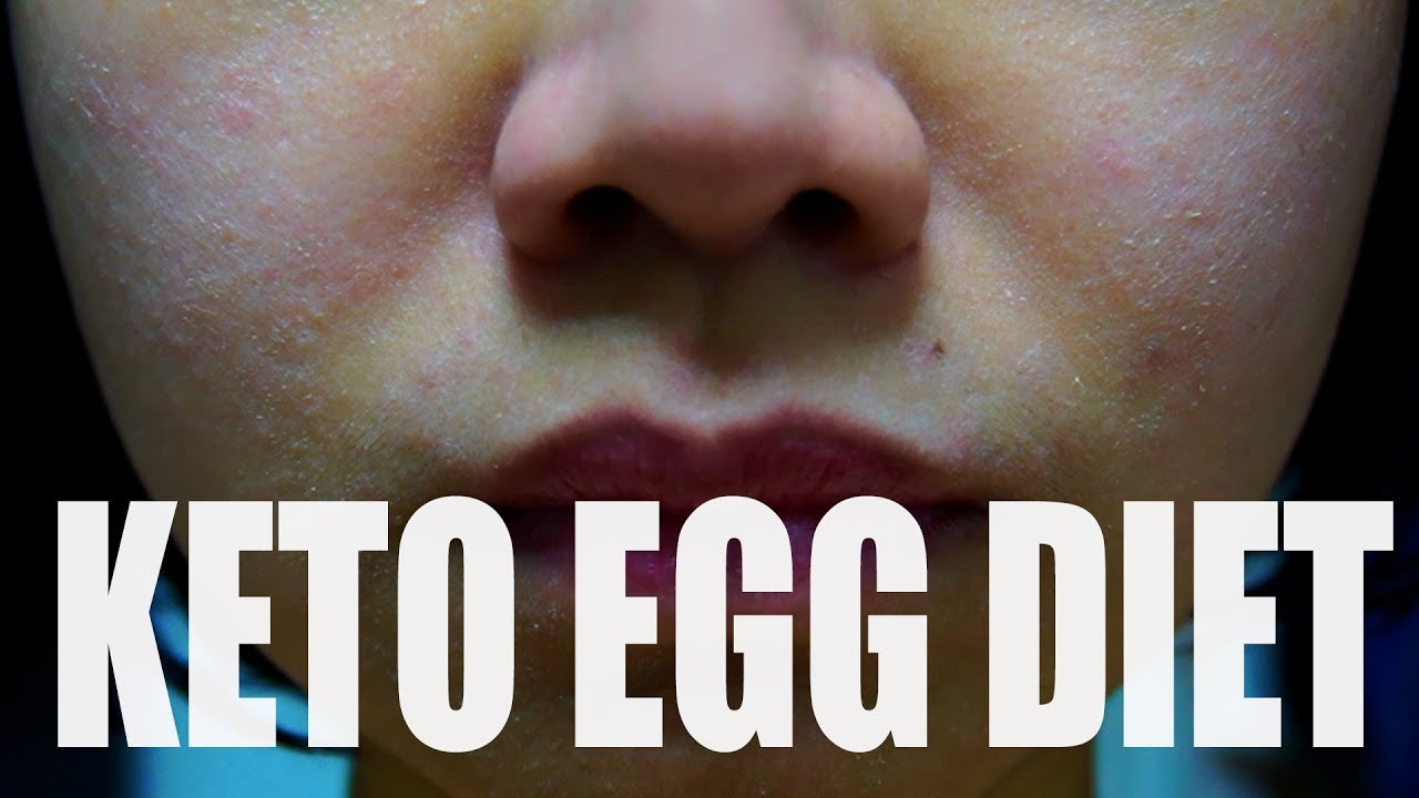 Egg Diet for Weight Loss | Keto Egg Fasting Philippines