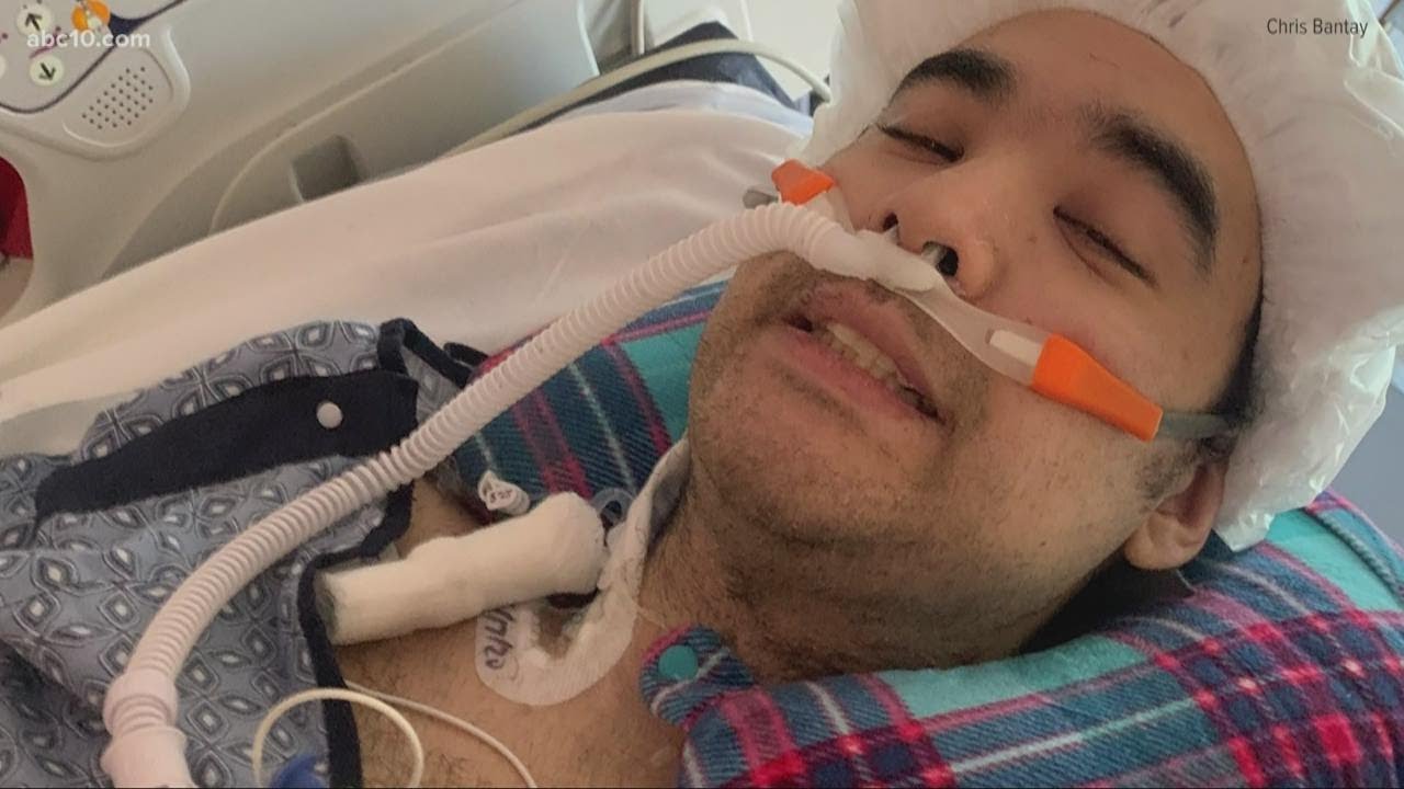 25-year-old suffers from spinal stroke
