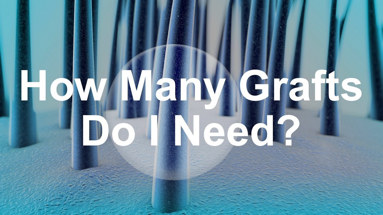 How Many Grafts Do I Need?