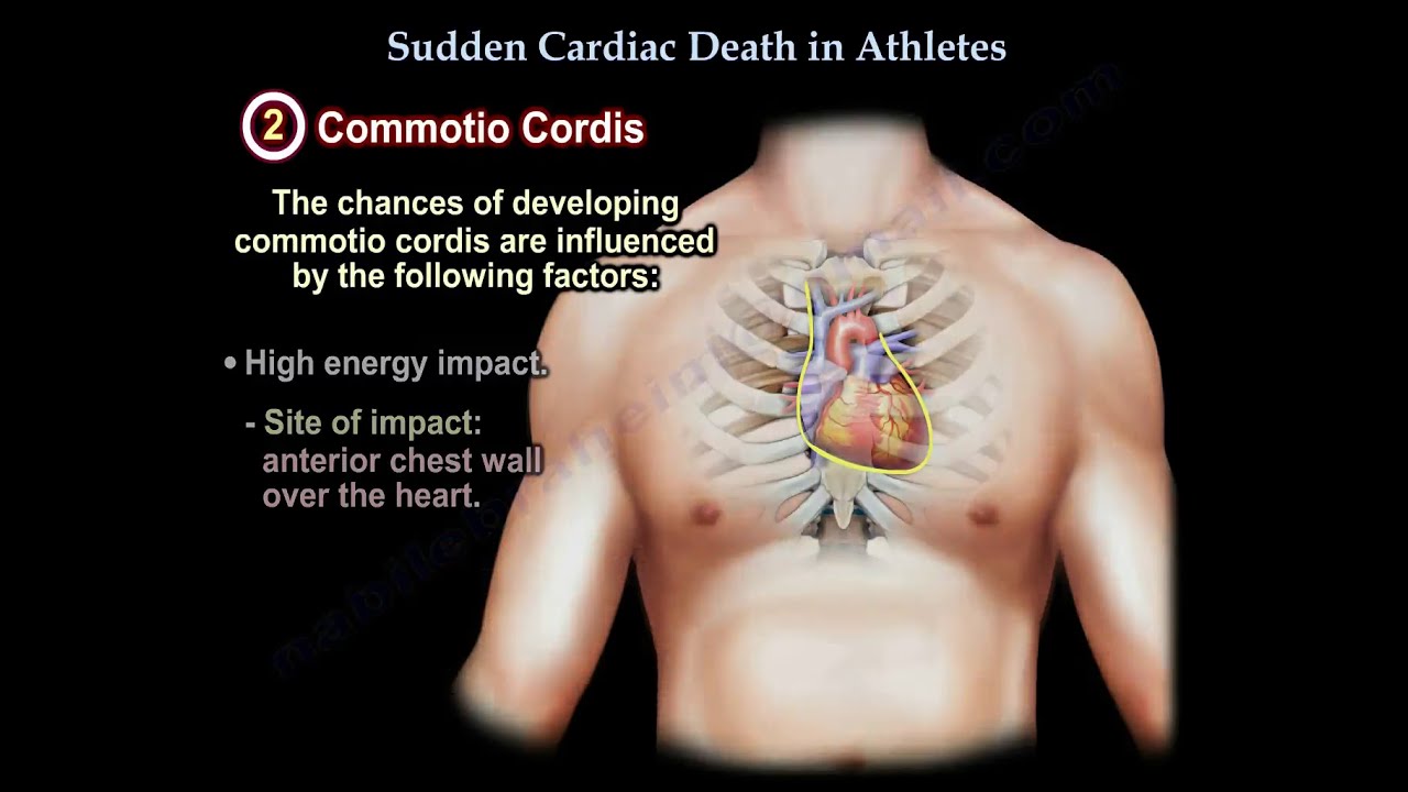Sudden cardiac Death In Athletes - Everything You Need To Know - Dr. Nabil Ebraheim
