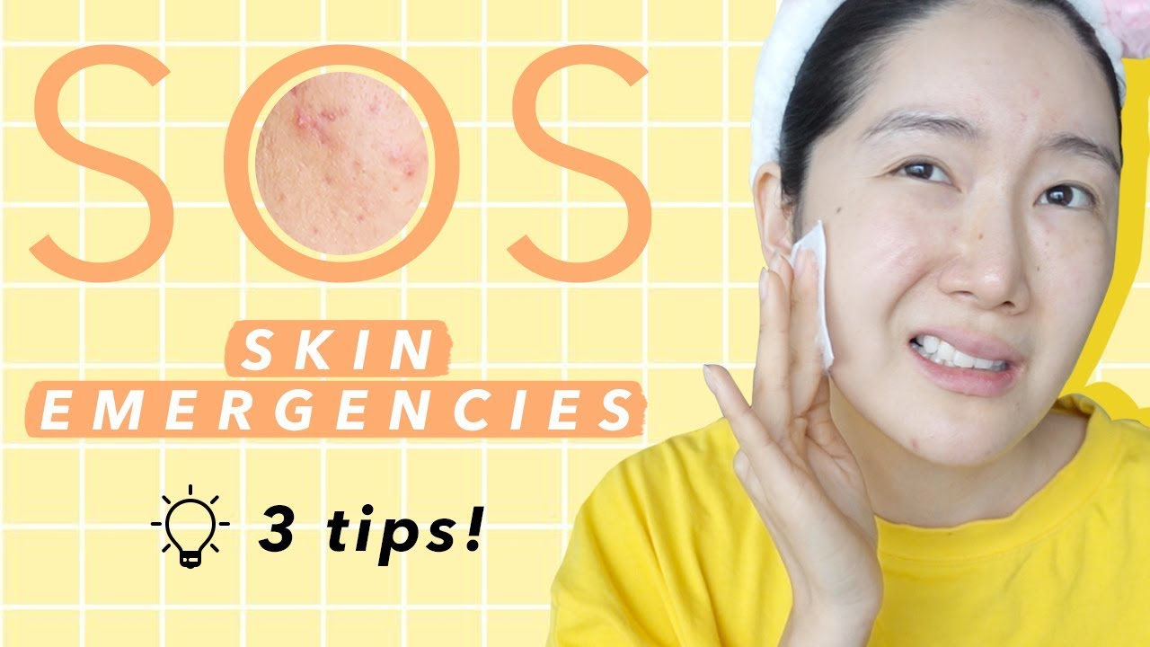 Pimple, Red, Irritated Skin Emergencies! Calm Skin Fast! #cicacream