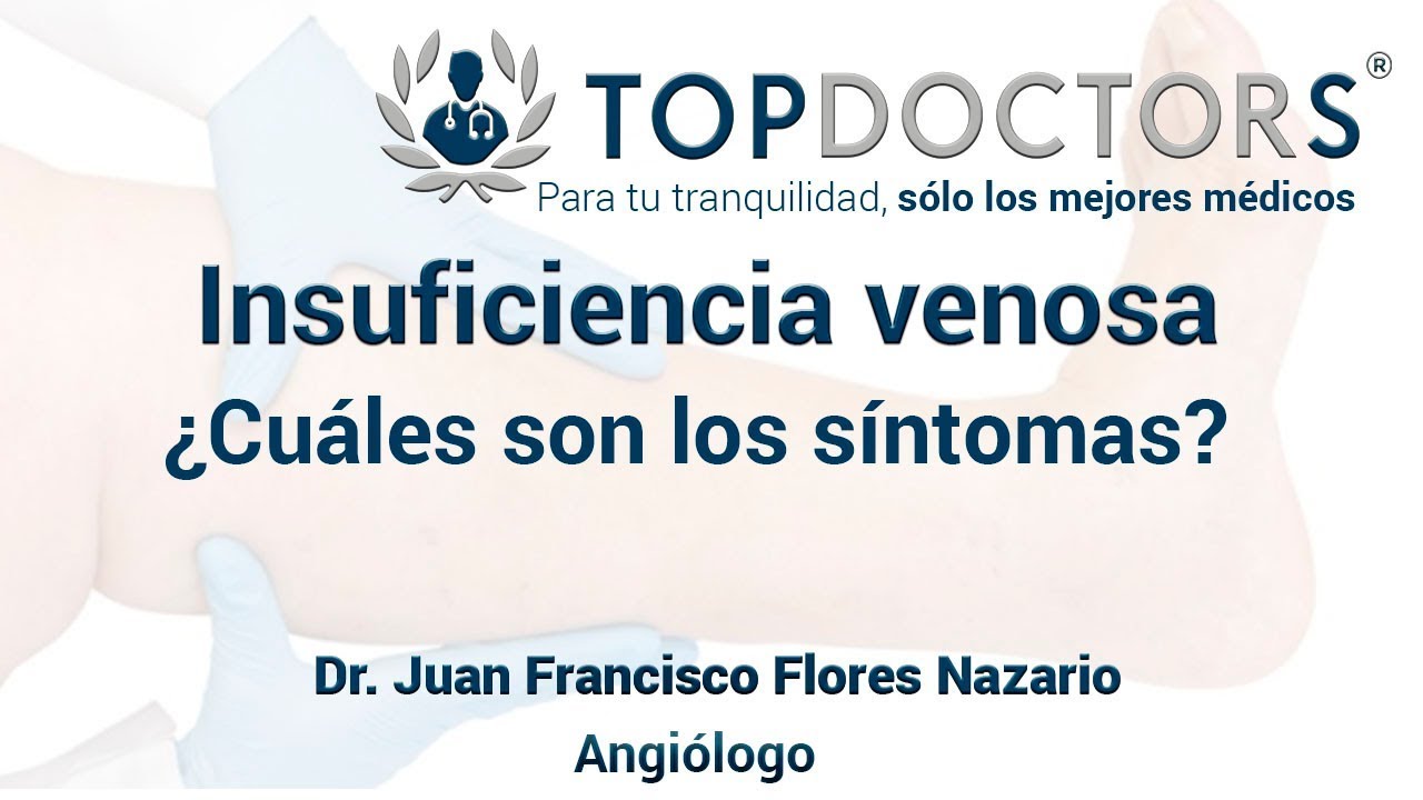 Síntomas de la insuficiencia venosa: Conoce todos los detalles