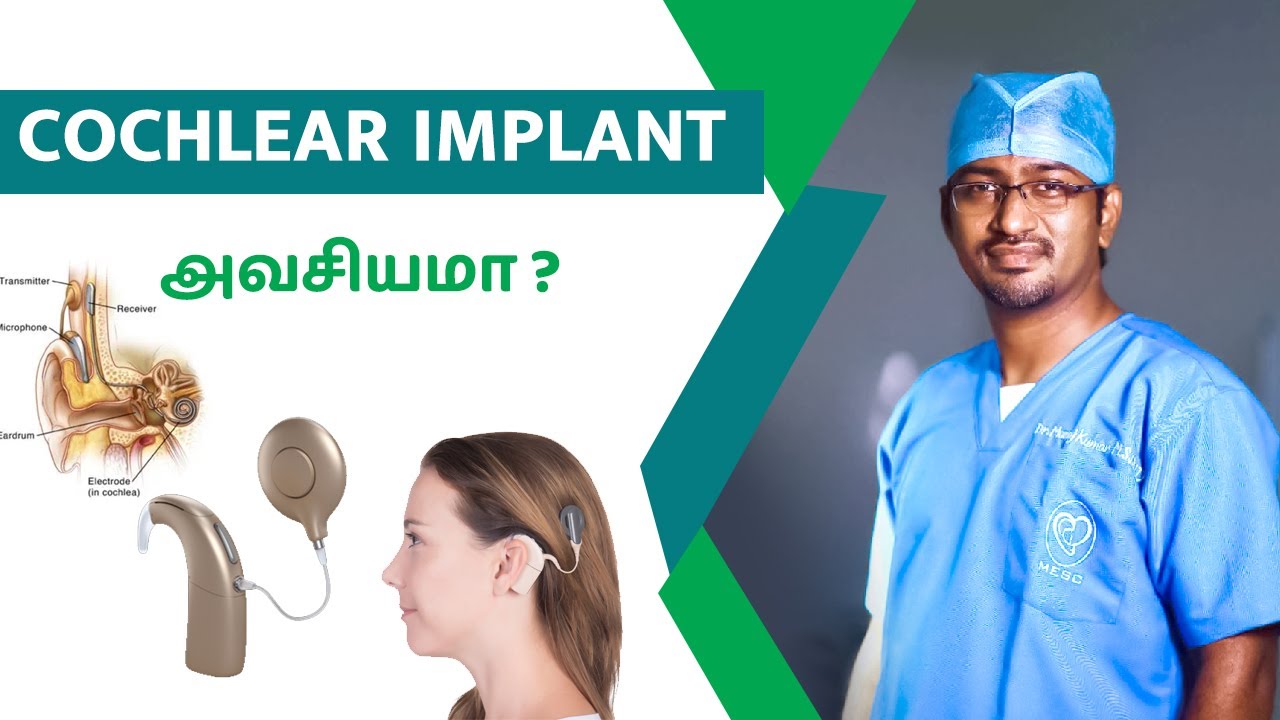 Cochlear Implant அவசியமா ?| Ear drum perforation in tamil | Dr. Manoj ENT Speciality Centre | Trichy
