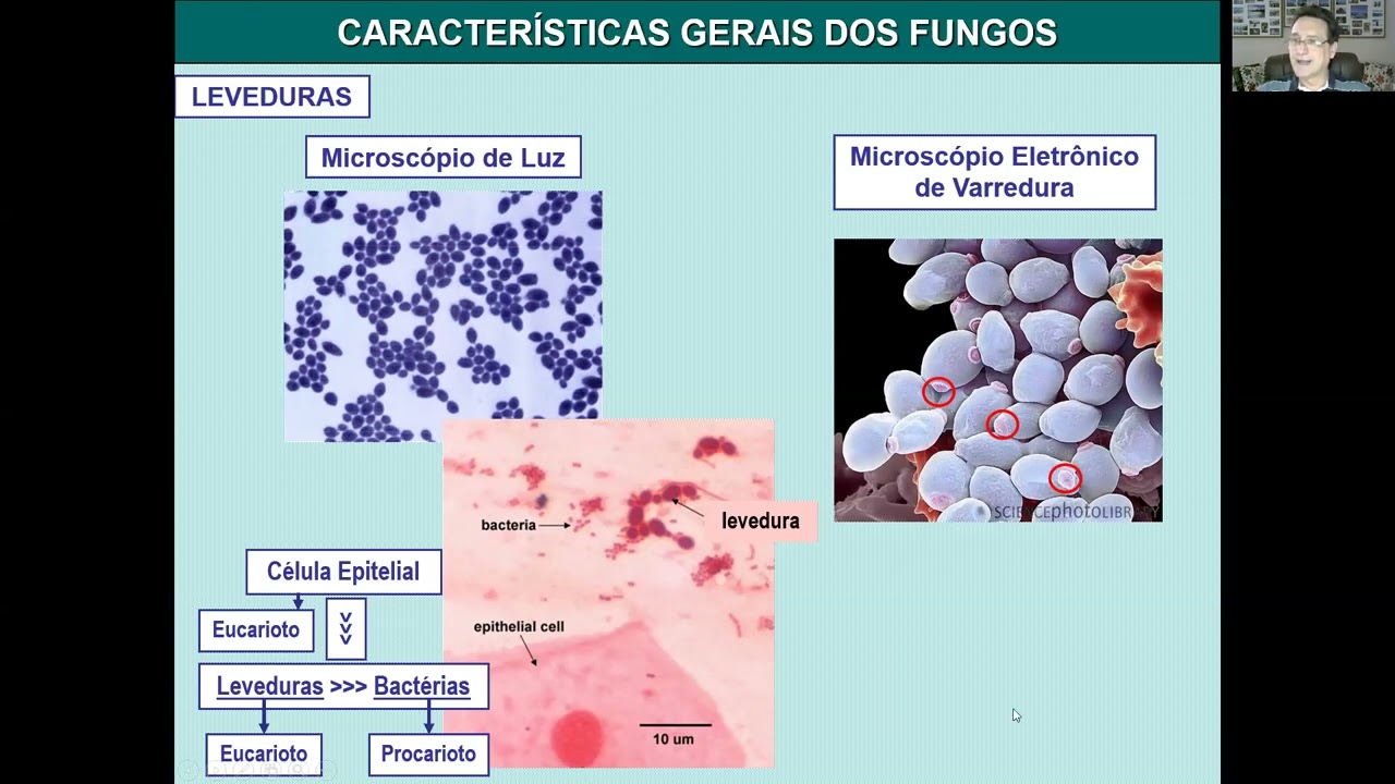 Aula 6    Caracteristicas Gerais dos Fungos